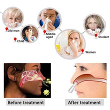 Carregar imagem no visualizador da galeria, Device for the Treatment of Rhinitis and Sinusitis - Rhinitis Therapy