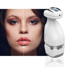Carregar imagem no visualizador da galeria, Focused Ultrasound Device - Lipo Hello Body
