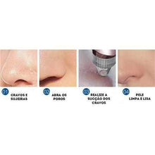 Carregar imagem no visualizador da galeria, Vacuum Blackhead Remover - PoreCleaner
